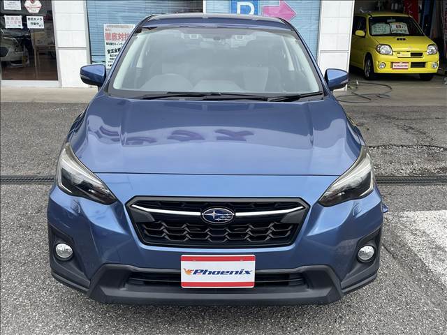XV