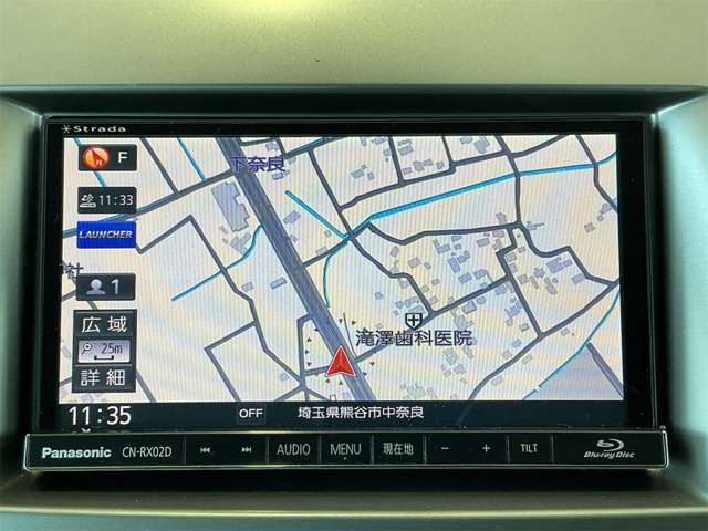 MPV